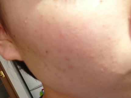 を使ったクチコミ(2枚目)