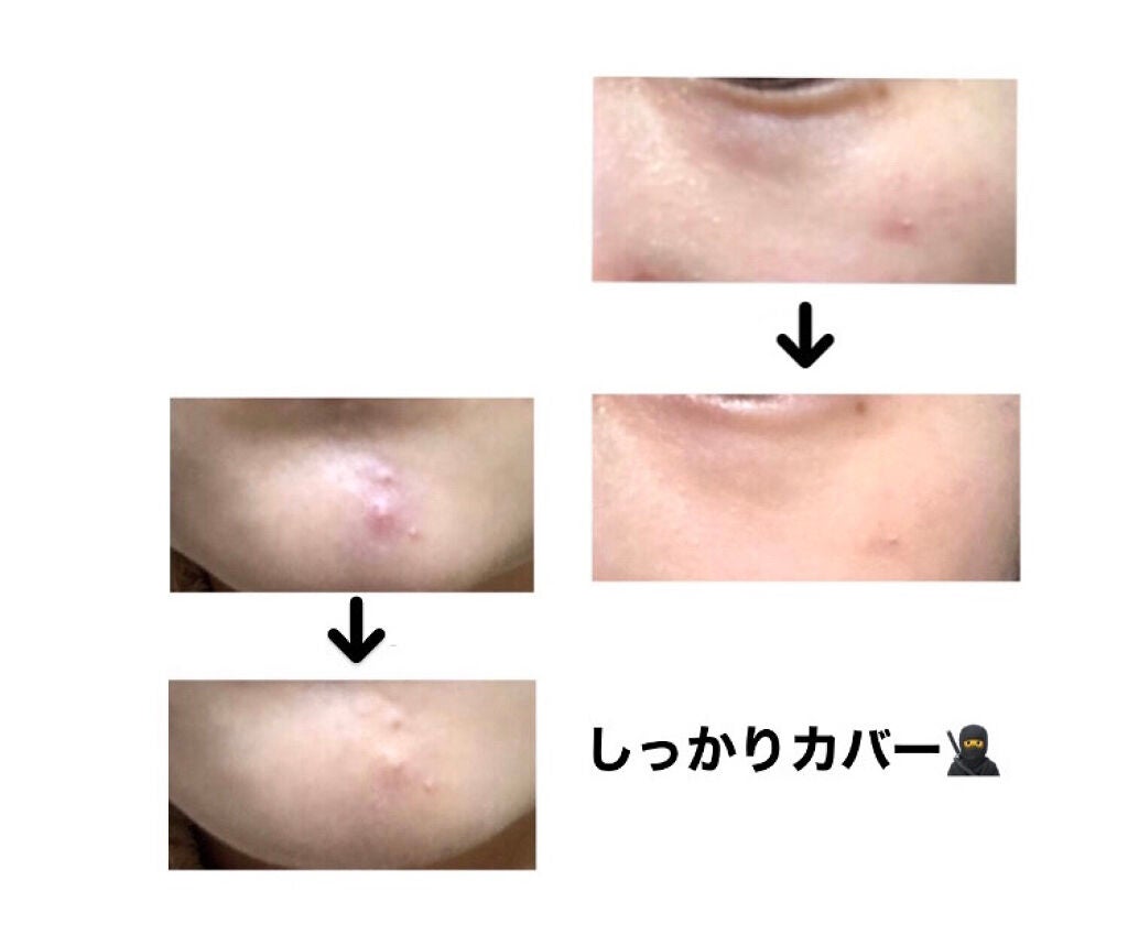 &be ファンシーラー/&be/パレットコンシーラーを使ったクチコミ(4枚目)