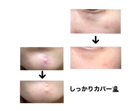 &be ファンシーラー/&be/パレットコンシーラーを使ったクチコミ(4枚目)