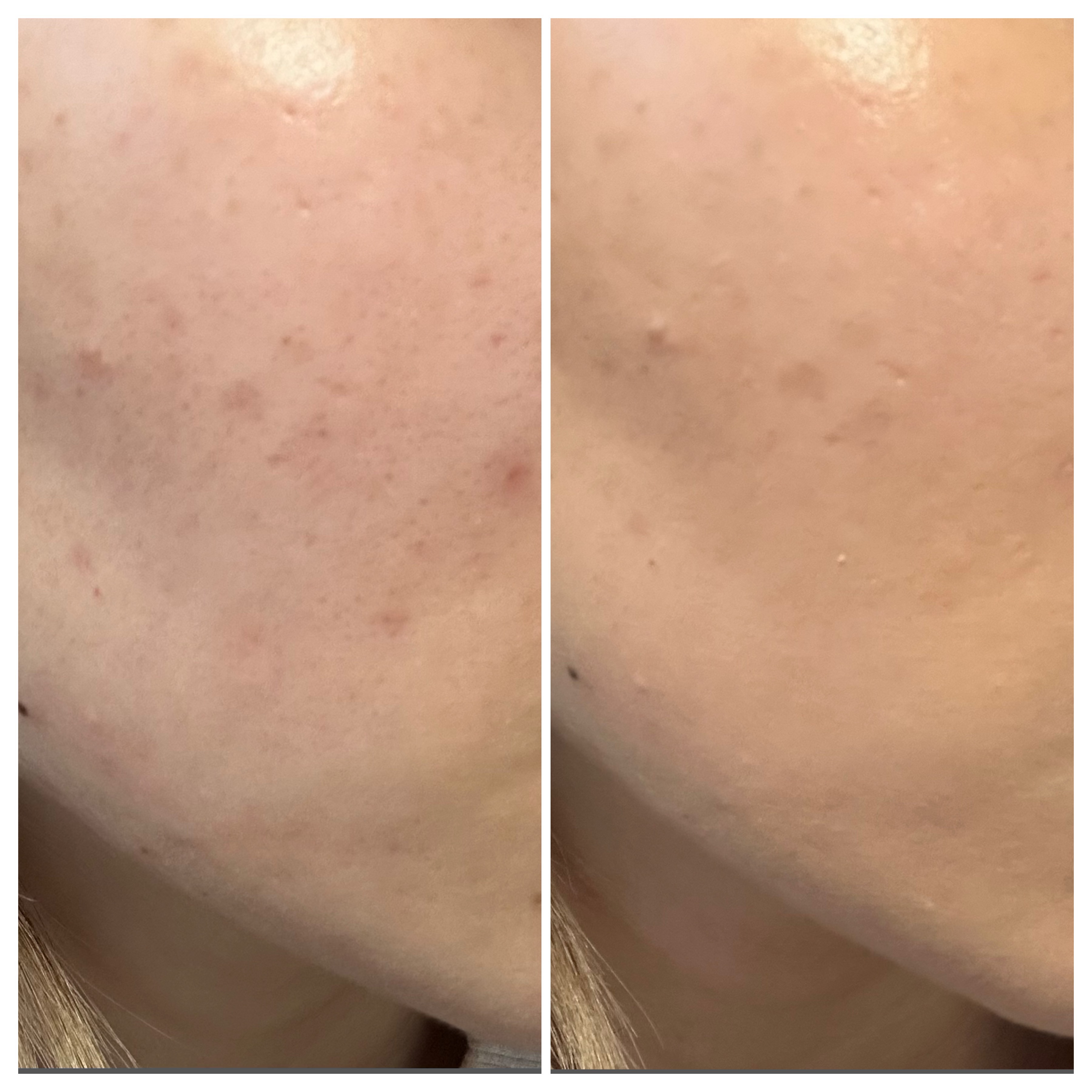 スタジオ ラディアンス セラム ファンデーション NC20/M・A・C/リキッドファンデーションを使ったクチコミ（2枚目）