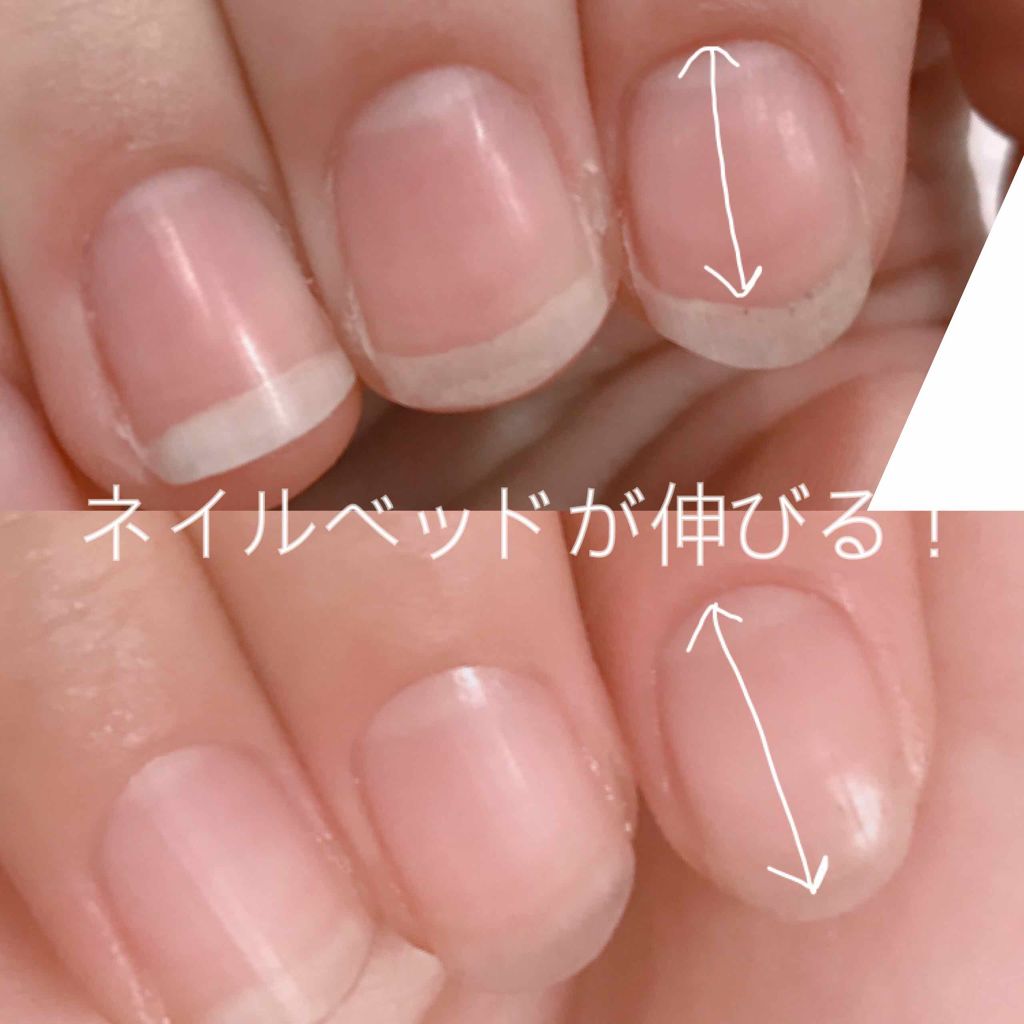 ネイルケアオイル/無印良品/ネイルオイル・トリートメントを使ったクチコミ（2枚目）