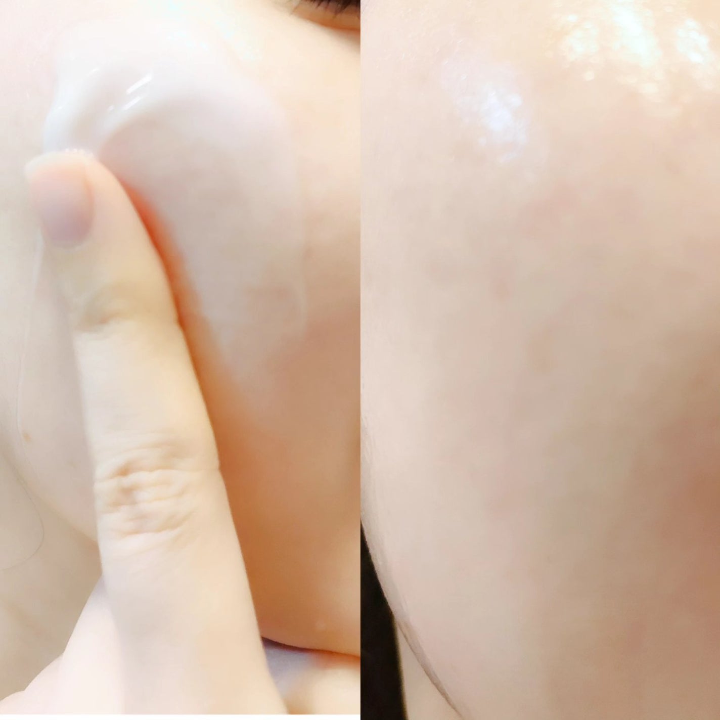 グルカミューンクリーム/VT/フェイスクリームを使ったクチコミ(6枚目)