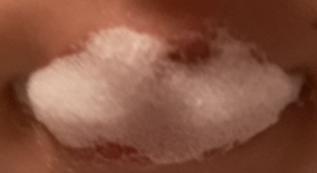 プルプルリップ/ピュレア/リップスクラブを使ったクチコミ(1枚目)