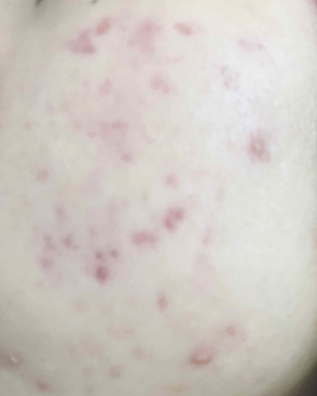 ネオグリーンオブグリーン/クロロフイル/化粧水を使ったクチコミ（2枚目）