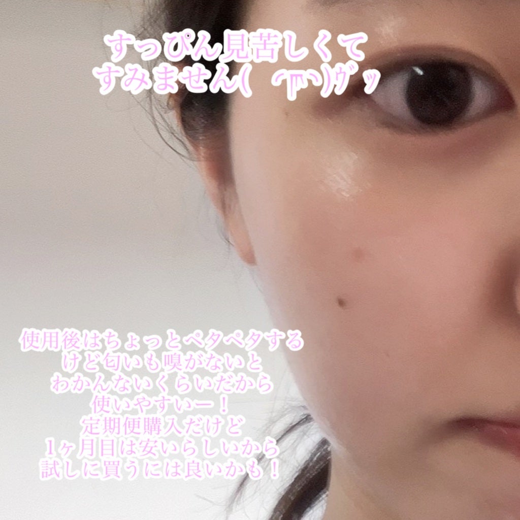 モイストゲルホワイト/Re dermalab/オールインワン化粧品を使ったクチコミ(5枚目)