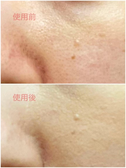 カバーパーフェクション チップコンシーラー/the SAEM/リキッドコンシーラーを使ったクチコミ(4枚目)