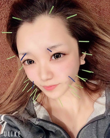 Ёrika on LIPS 「【すっぴん失礼します🙇‍♂️】今日は美容鍼に行ってきた✨最近女..」（1枚目）
