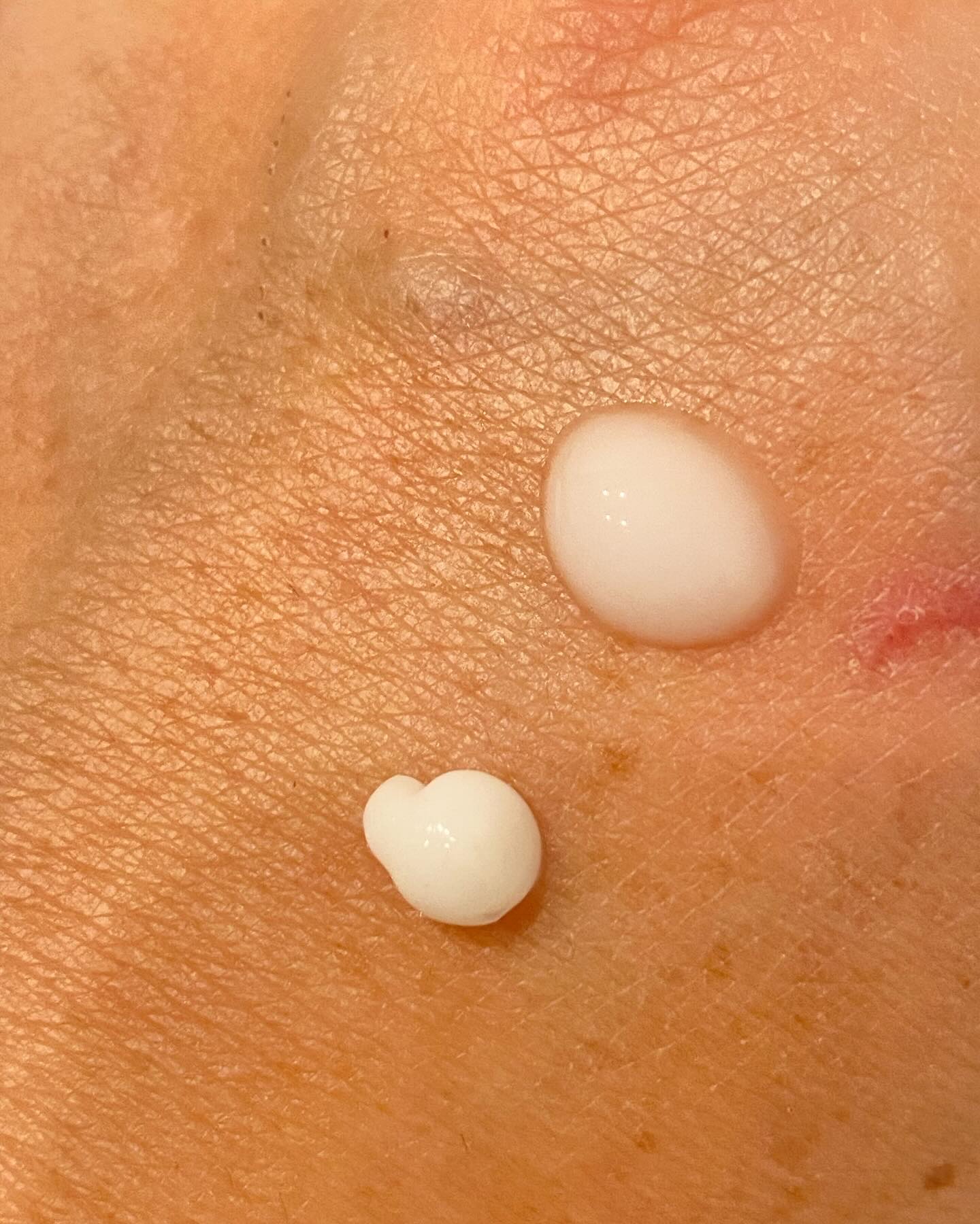 マイルドリードルショット50/VT/美容液を使ったクチコミ（3枚目）