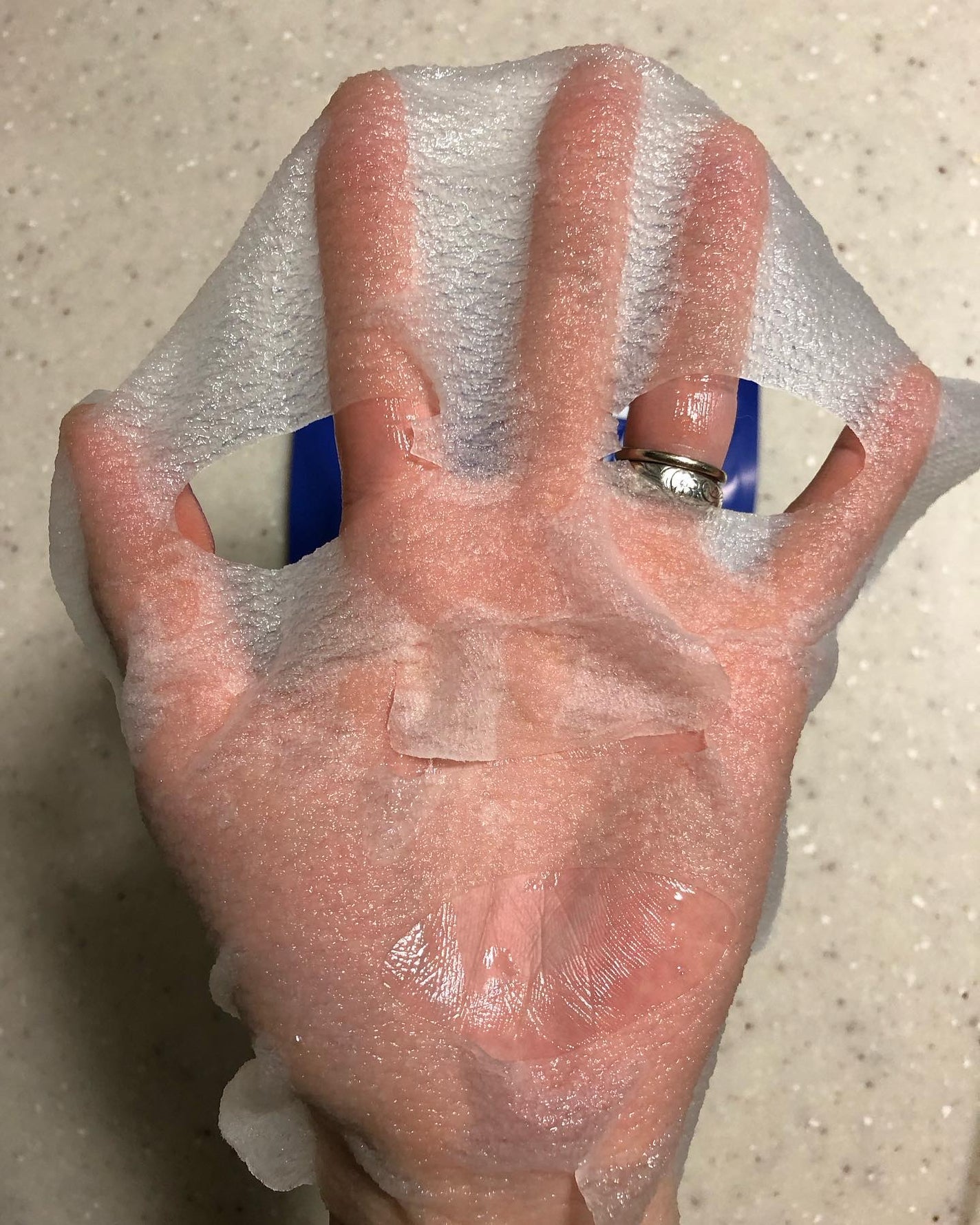 毛穴小町 テカリ源治 マスク/クリアターン/シートマスク・パックを使ったクチコミ(2枚目)