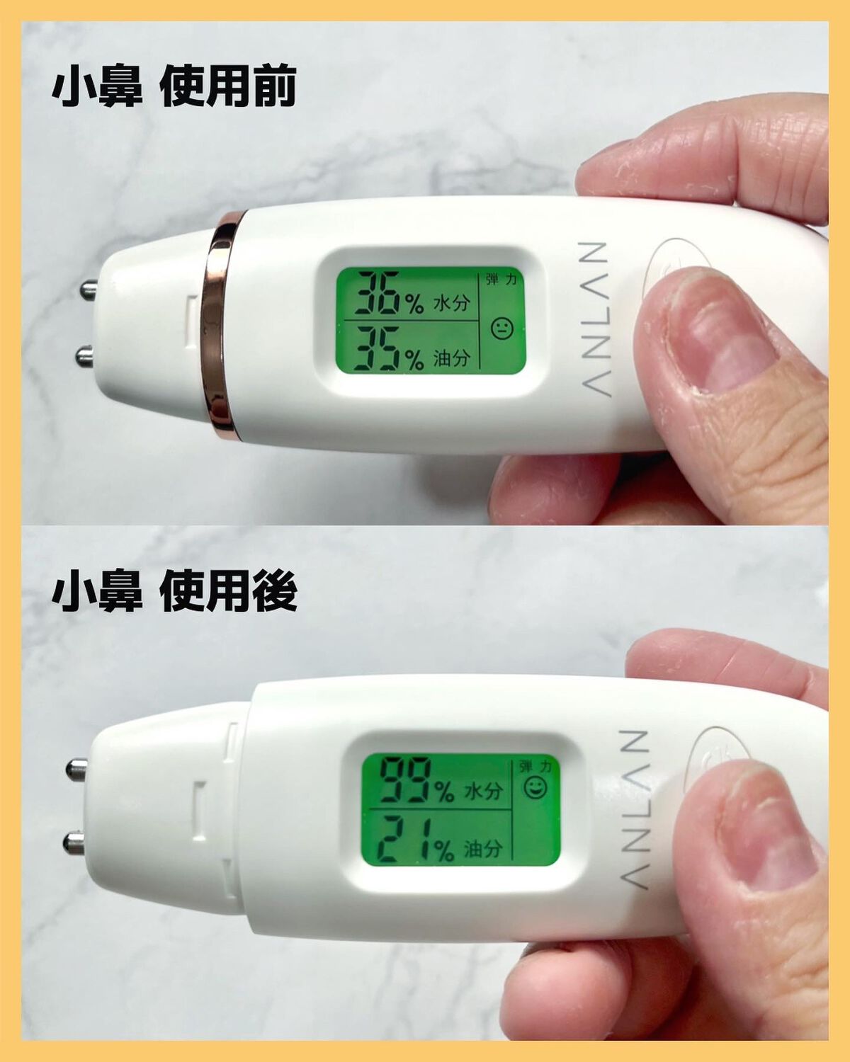 お米もっちりエステパック/COSRX/洗い流すパック・マスクを使ったクチコミ(5枚目)