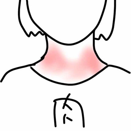 ベトネベートN軟膏AS(医薬品)/第一三共ヘルスケア/その他を使ったクチコミ(2枚目)