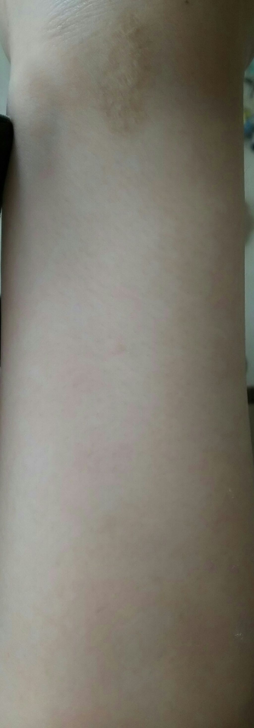 ゆに on LIPS 「汚くてすみません(、._.)、皆さんは腕や足などの毛をカミソリ..」(2枚目)