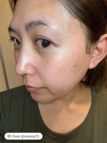 ネイチャーコンク 薬用クリアローション/ネイチャーコンク/拭き取り化粧水を使ったクチコミ(6枚目)