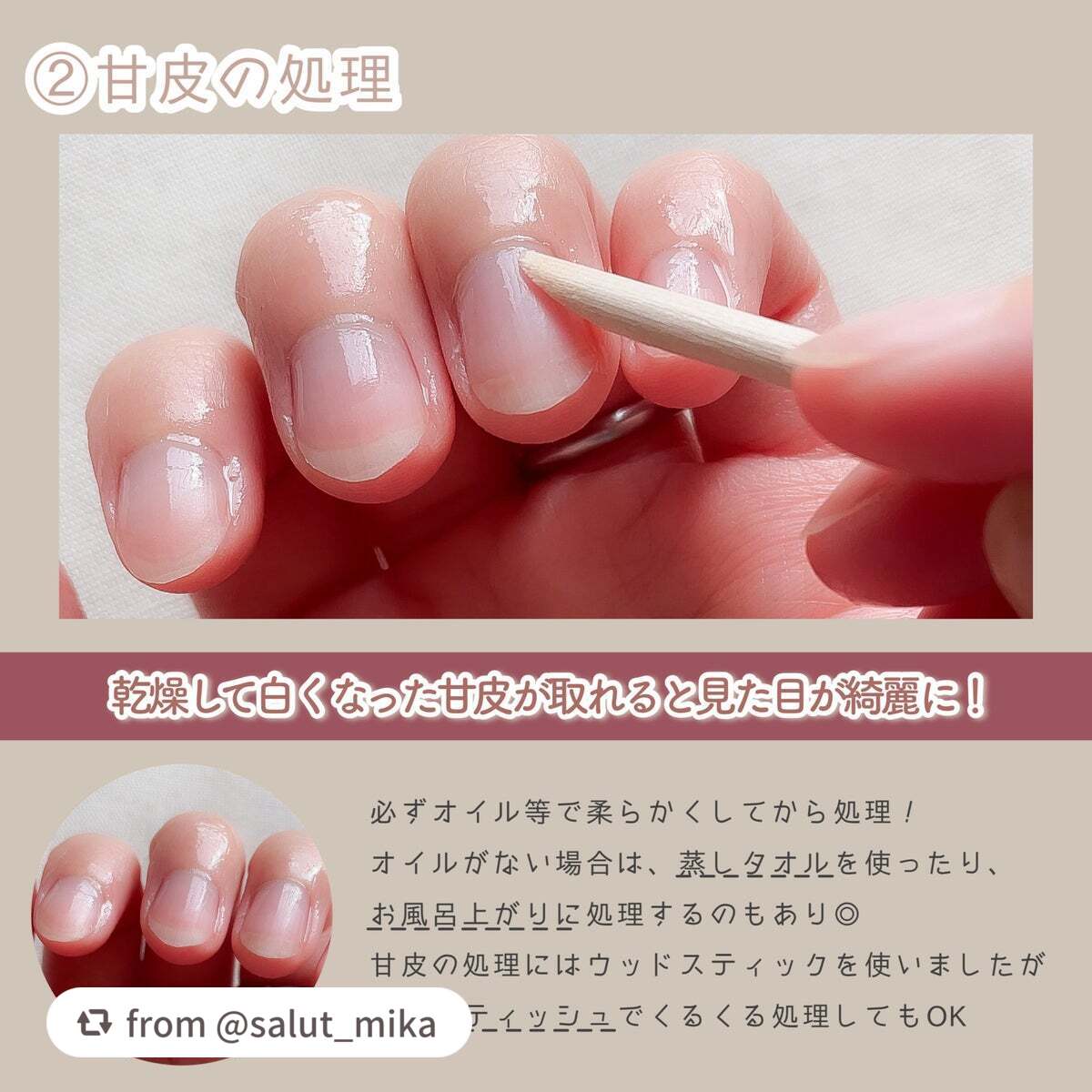 ストロングガード/D-UP/ネイル・ネイルケアを使ったクチコミ(5枚目)