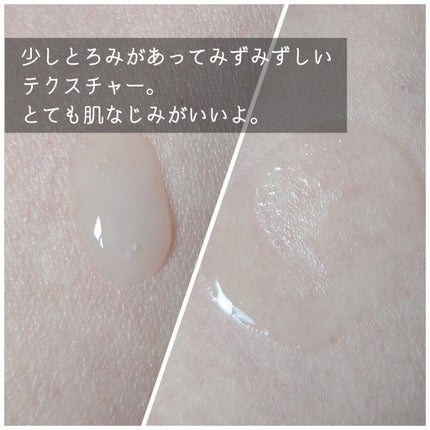 アルティミューン™ パワライジング セラム/SHISEIDO/美容液を使ったクチコミ(3枚目)