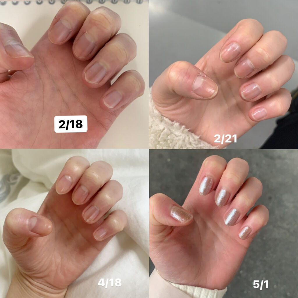 キューティクルオイル/ネイルホリック/ネイルオイル・トリートメントを使ったクチコミ（2枚目）