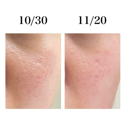 CICA デイリースージングマスク/VT/シートマスク・パックを使ったクチコミ(4枚目)