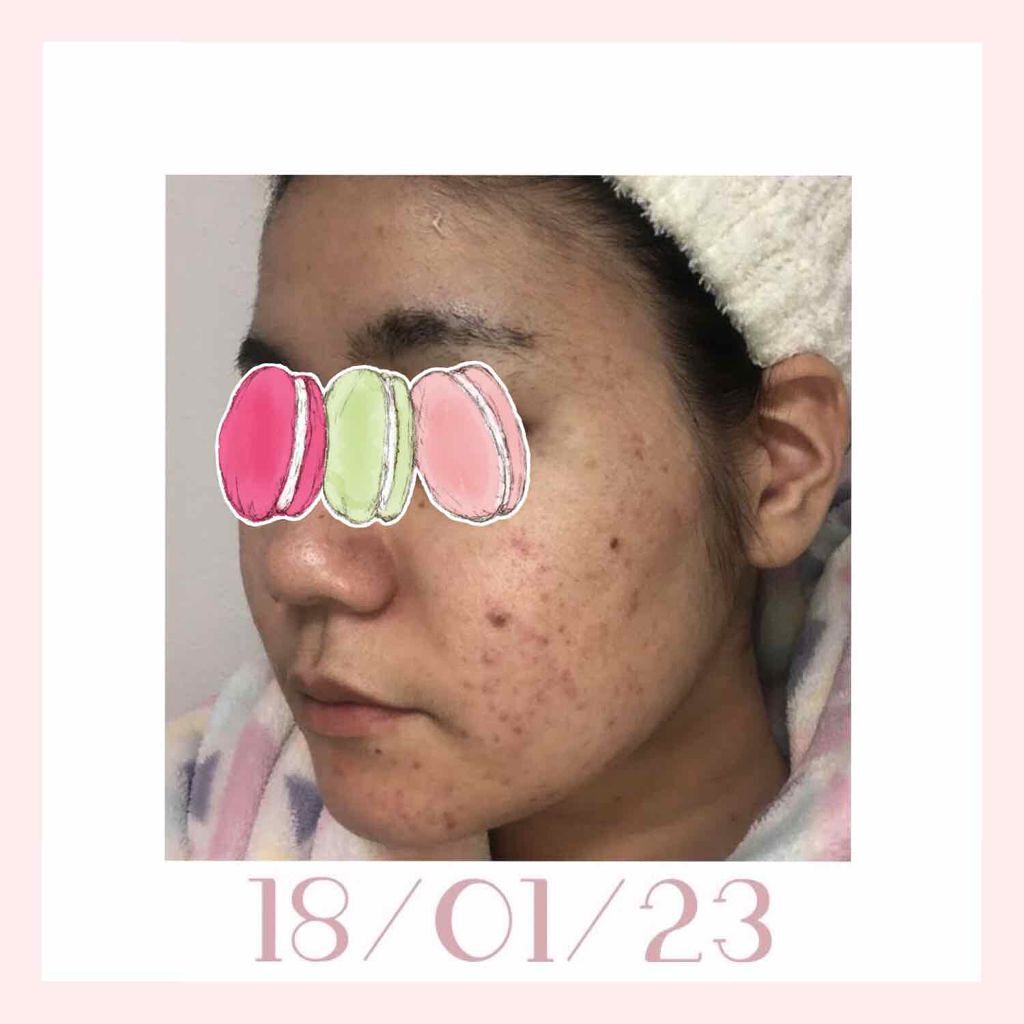 おうちdeエステ 肌をやわららかくする マッサージ洗顔ジェル/ビオレ/その他洗顔料を使ったクチコミ(3枚目)