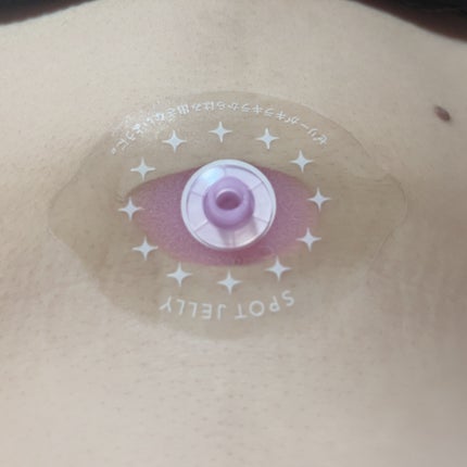 SPOT JELLY(スポッ!とジェリー)へそごまパック/花王/その他スキンケアを使ったクチコミ(5枚目)