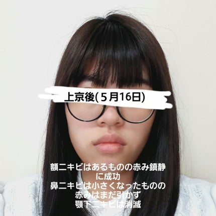 ノスカナインTCトナーS/FATION/化粧水を使ったクチコミ(4枚目)