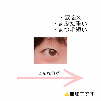 アイトーク/アイトーク/二重まぶた用アイテムを使ったクチコミ(2枚目)