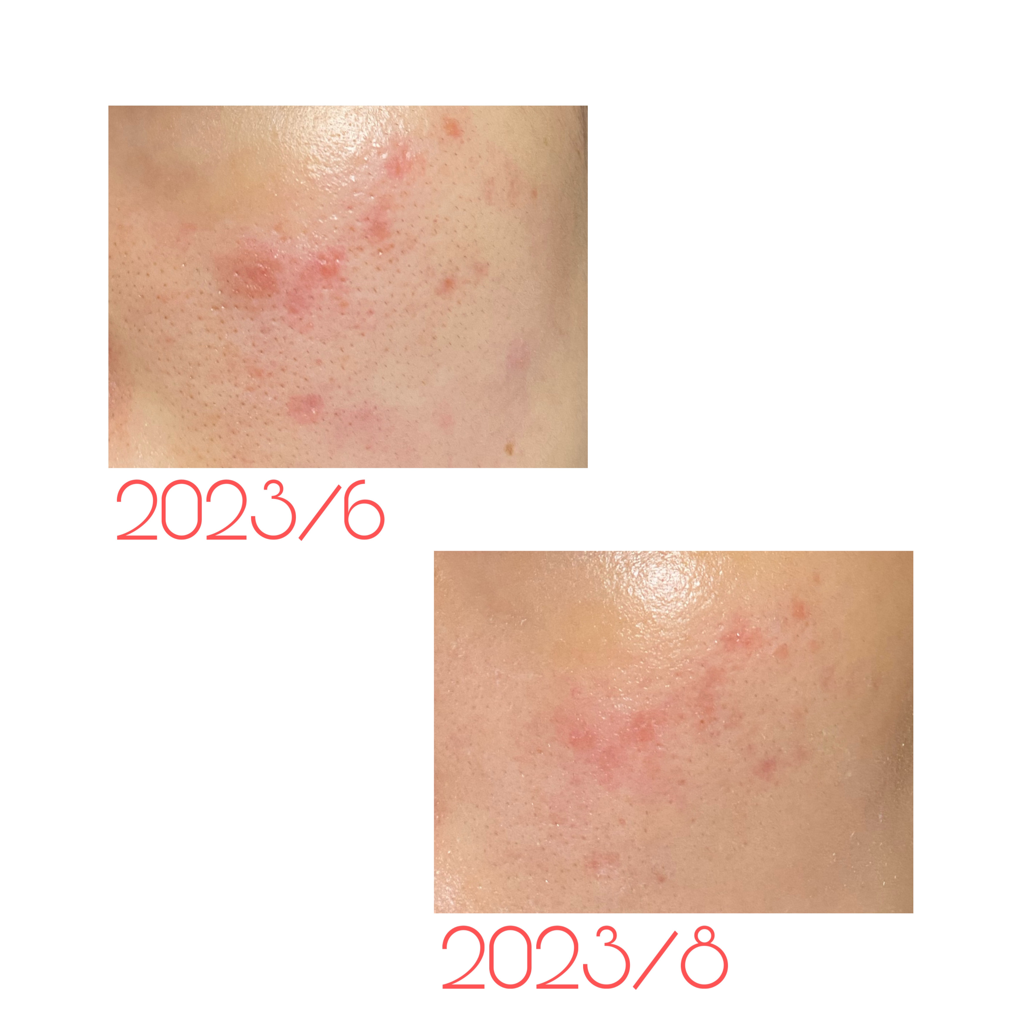 スーパーリンクルクリームVA/KISO/フェイスクリームを使ったクチコミ（2枚目）