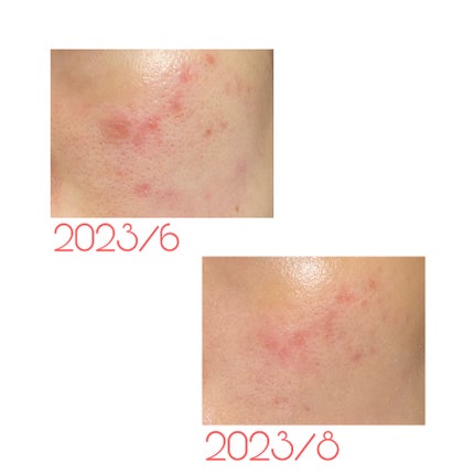 オイルセラム RE/KISO/美容液を使ったクチコミ(2枚目)