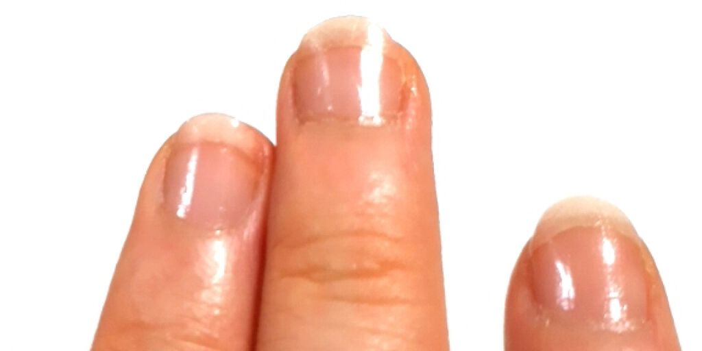 ネイルサポート ピンク/ネイルネイル/ネイルベースコートを使ったクチコミ（1枚目）