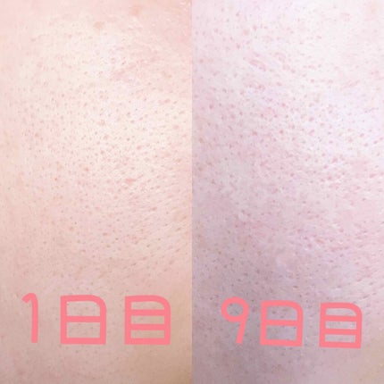 塗る米ぬか乳液/米一途/乳液を使ったクチコミ(4枚目)