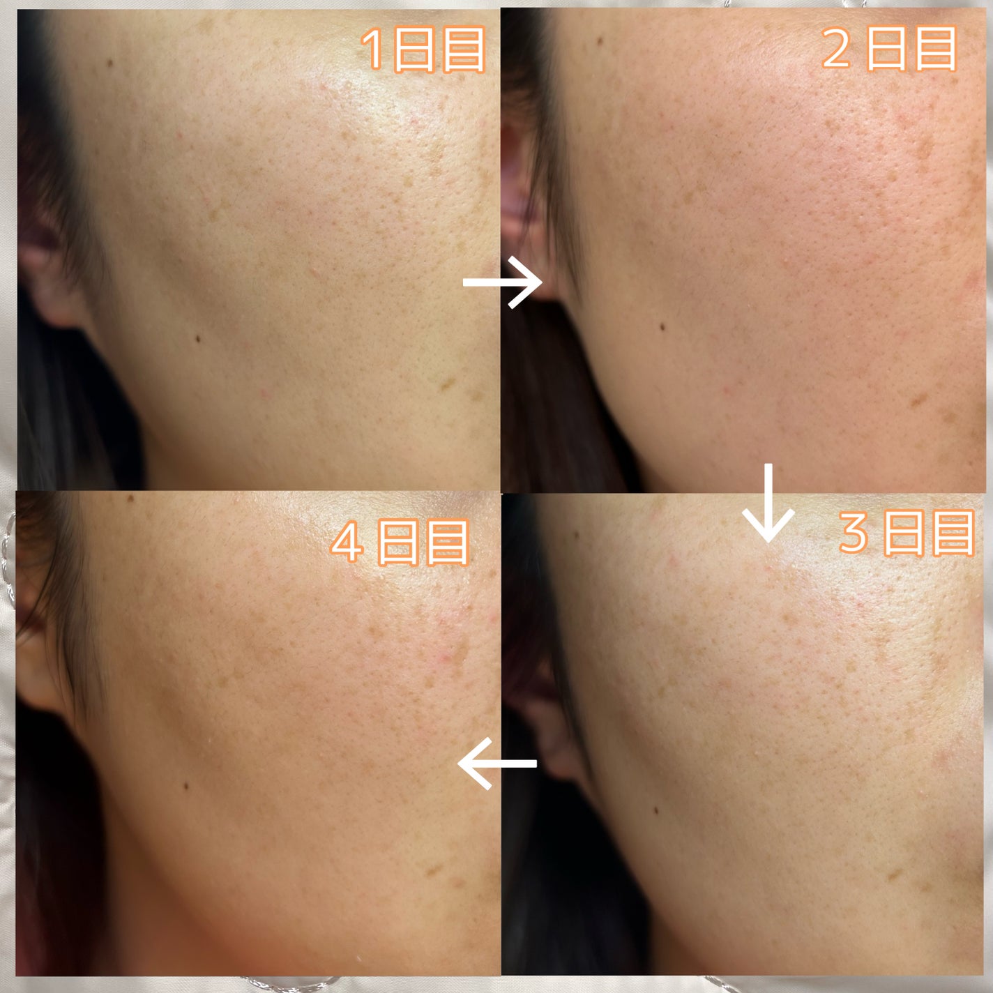 リードルS 100 2ステップマスク/VT/シートマスク・パックを使ったクチコミ(7枚目)