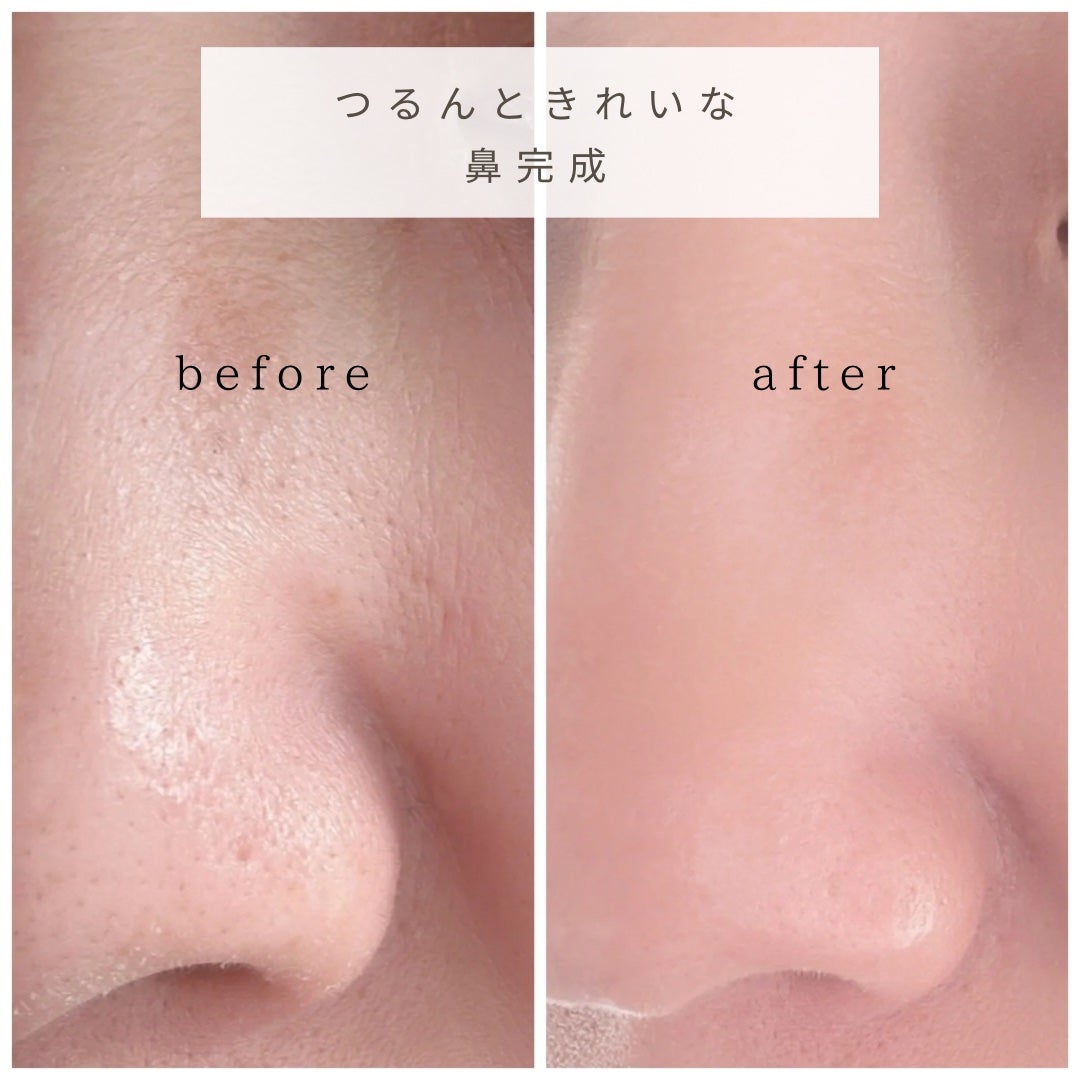 ナチュラルマイルドクリアノーズパック/ilso/シートマスク・パックを使ったクチコミ(6枚目)