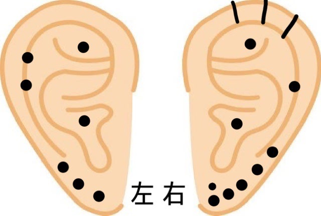 ゆち。 on LIPS 「♡個人的ピアスの痛みランキング♡右耳ロブ5連ロブの上に1つヘリ..」(2枚目)