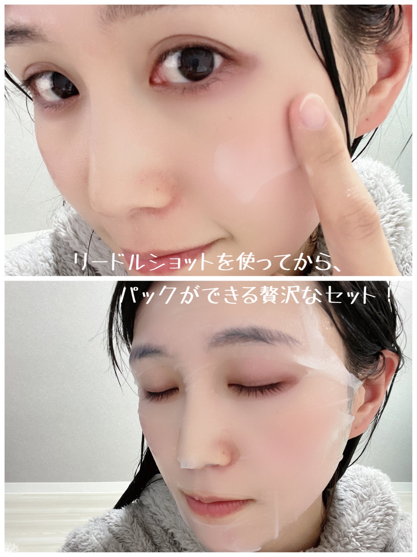 リードルショット100/VT/美容液を使ったクチコミ(4枚目)