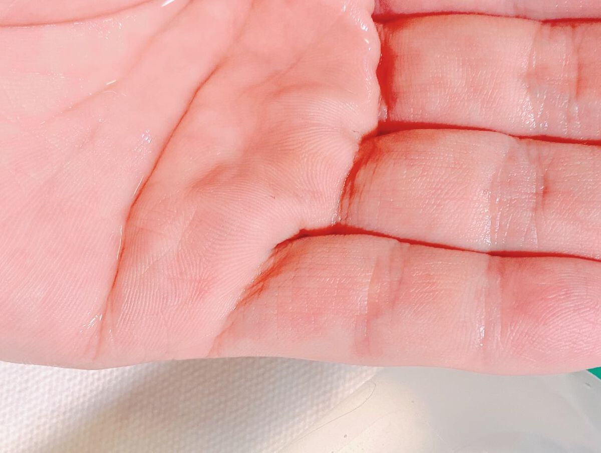 シカ80％ヒアルロン酸トナー/Frankly/化粧水を使ったクチコミ（3枚目）