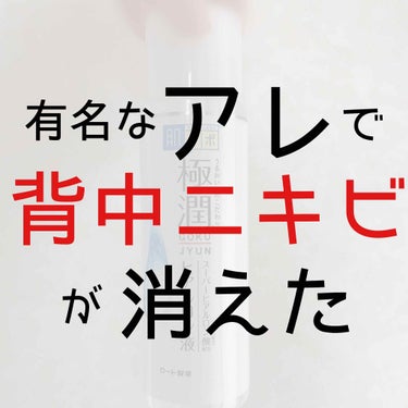 背中ニキビに悩んでる人〜🙋‍♀️🙋🙋‍♂️〜！！

もう、ただでさえ顔のニキビで悩んでるのに背中までニキビできるってなんなの？って感じですよね😡

周りからは「大人になったら治るよ」って言われてもそれま