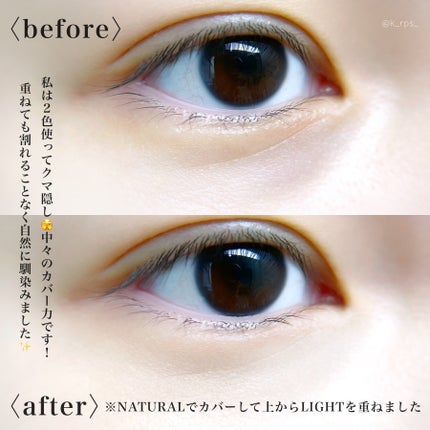 カバーアッププロコンシーラー/TFIT/パレットコンシーラーを使ったクチコミ(4枚目)