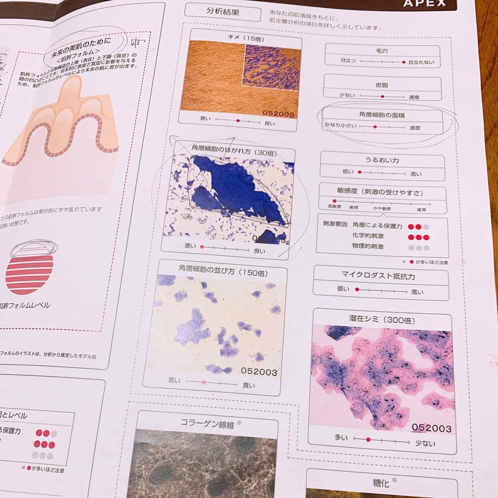 み さ き on LIPS 「万年ニキビ&ニキビ肌で悩んでるみっさんの雑談投稿です……😢前回..」(2枚目)