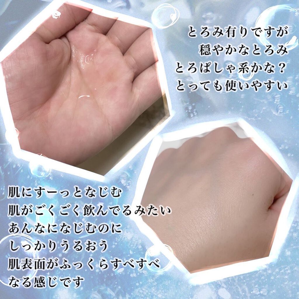 マイクロ エッセンス ローション BF/ESTEE LAUDER/化粧水を使ったクチコミ（3枚目）