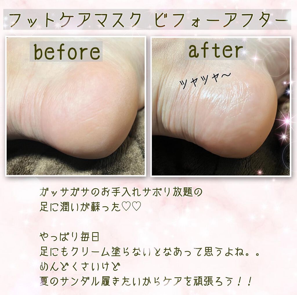 スペシャルケア ハンド マスク/innisfree/ハンドクリームを使ったクチコミ(7枚目)