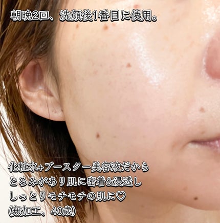 ライト イット アップ エッセナー/SIORIS/ブースター・導入液を使ったクチコミ(3枚目)