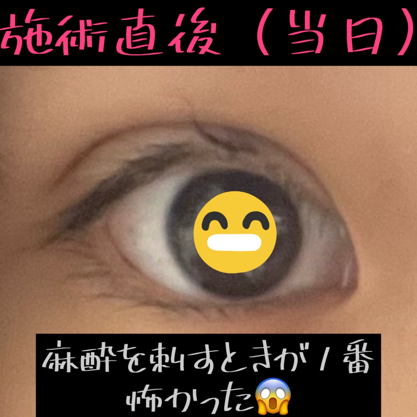 ãã³ on LIPS ãðåæ²¡ããŠ1ã¶æçµã¡ãŸããðãŸã è
«ããŠããŸãããã ãã¶è
«ããã²..ãïŒ2æç®ïŒ