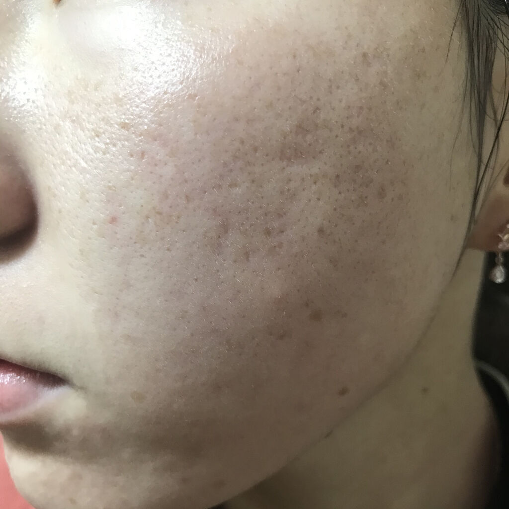 LA10+HAフェイスセラム/The Ordinary/ピーリングを使ったクチコミ（2枚目）