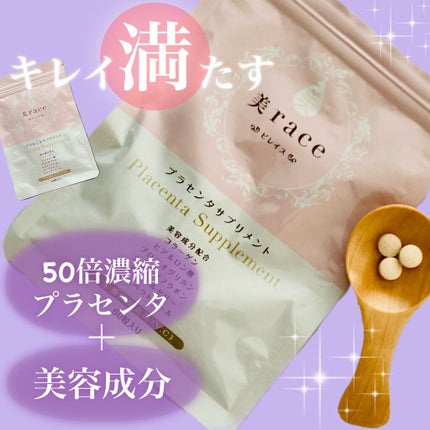 美race(ビレイス) ビタミンC/Ange/美容サプリメントを使ったクチコミ(1枚目)