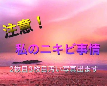 みなさんこんにちは！
ﾋﾒｺです！


お待たせしましたー！
(待っている人はきっといない笑)

今回は私のニキビ事情についてご紹介？しようと思います！


私は小学4年生頃からニキビちゃんが出てきちゃ