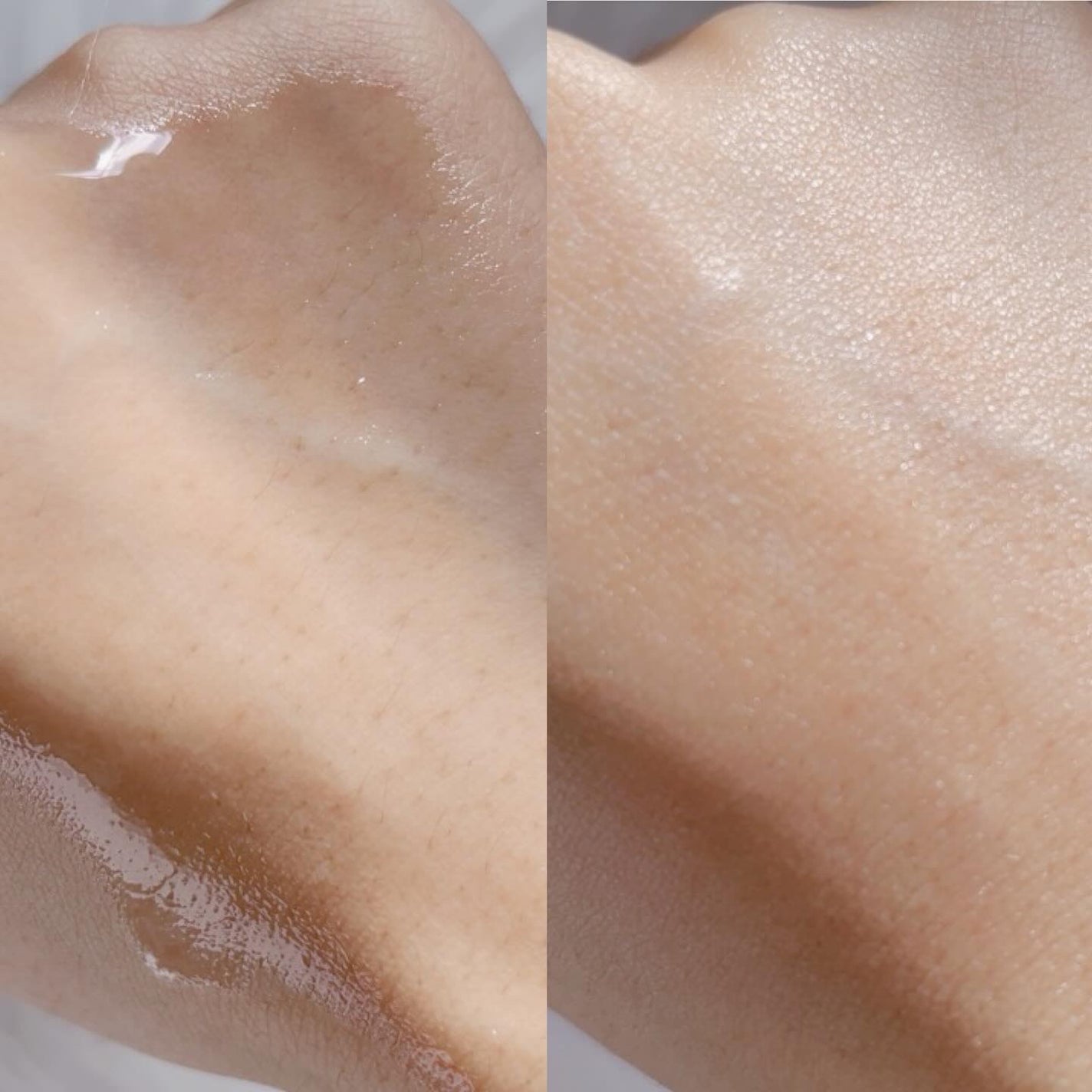 DW-EGFワンデイズアンプル/Easydew/美容液を使ったクチコミ(5枚目)