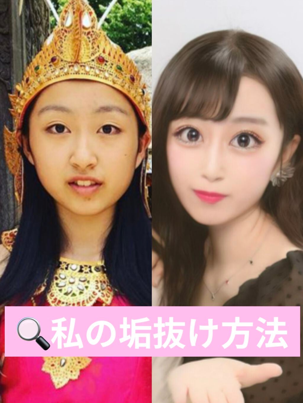 ãŸããðââ¬ðª on LIPS ã仿¥ã¯ç§ã®å¢æãæ¹æ³ã«ã€ããŠã話ããŸããïŒïŒâ¡ãã€ã³ã1èªåã®..ãïŒ1æç®ïŒ