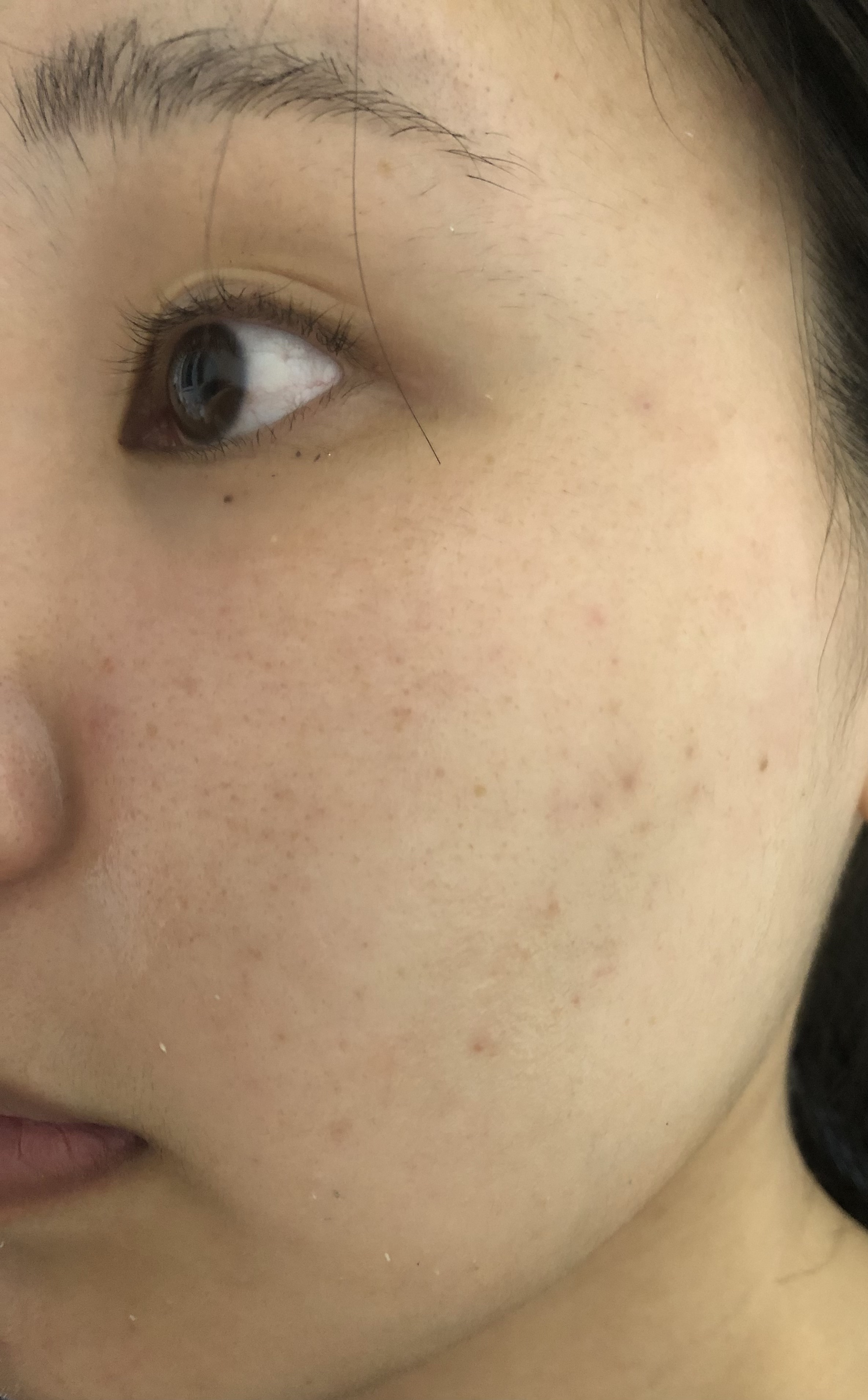 RXザ・レチノール0.1クリーム/COSRX/フェイスクリームを使ったクチコミ（1枚目）