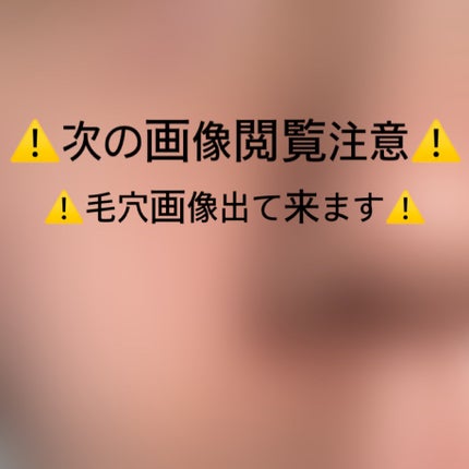 リードルショット100/VT/美容液を使ったクチコミ(6枚目)