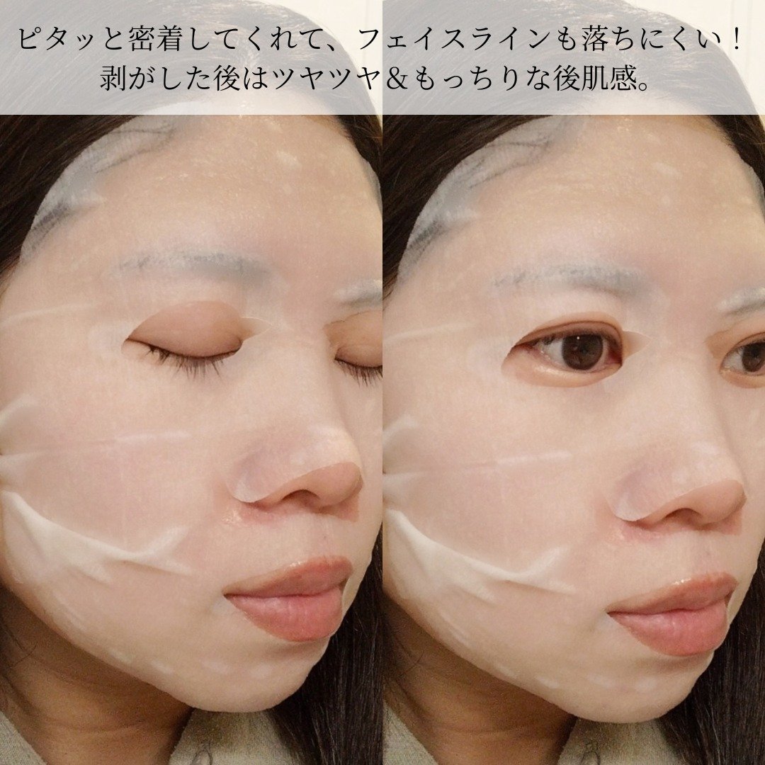 ルルルン ハイドラ EX マスク/ルルルン/シートマスク・パックを使ったクチコミ（3枚目）