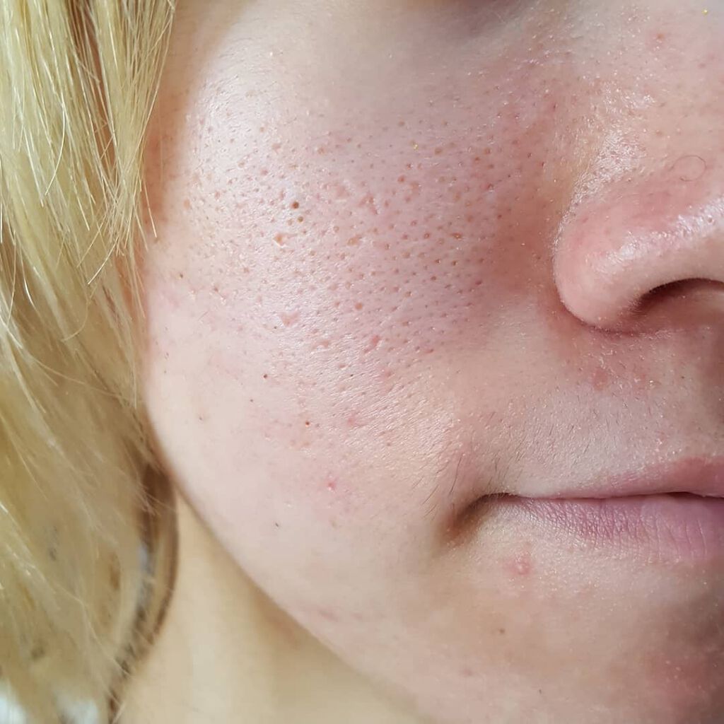 BBクッションファンデーション/Joy.coco(ジョイココ)/クッションファンデーションを使ったクチコミ(3枚目)